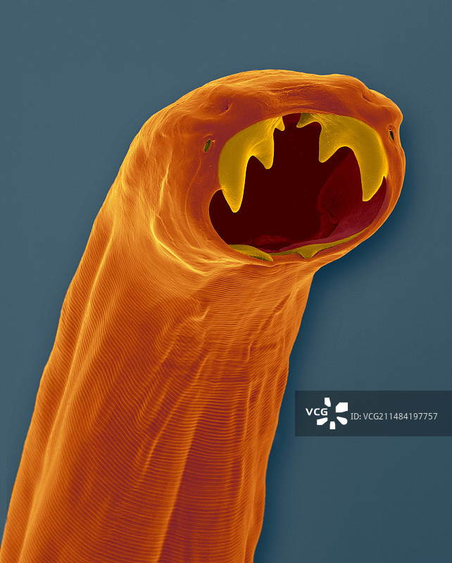 猫钩虫（巴西钩口线虫），扫描电子显微镜图片素材