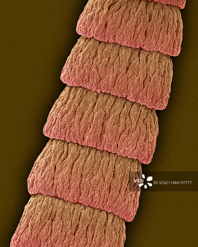 犬复孔绦虫节片扫描电镜图图片素材
