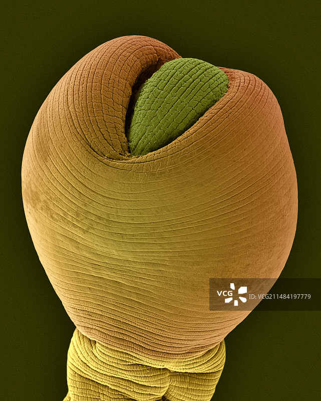 犬绦虫囊尾蚴期，扫描电镜图片素材