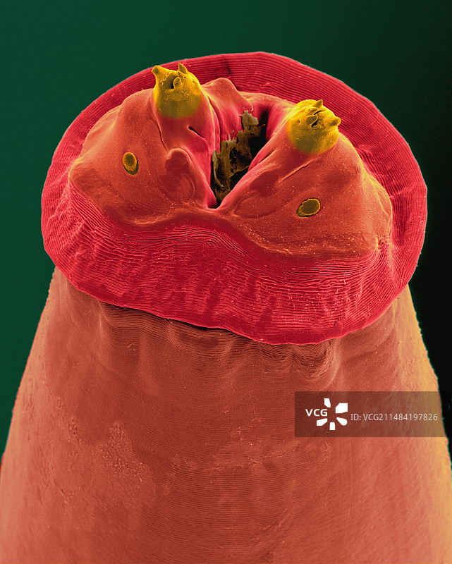 浣熊肠道蛔虫扫描电镜图图片素材