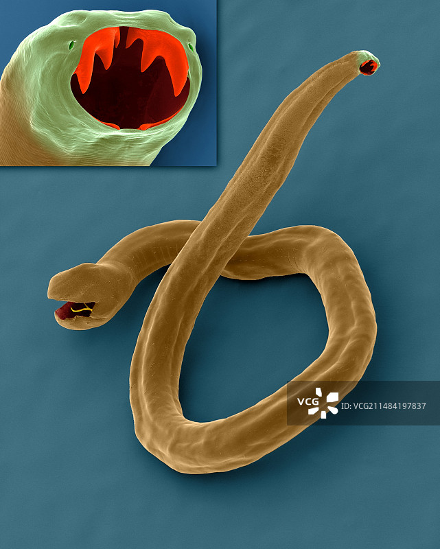 犬钩虫（Ancylostoma caninum），扫描电镜图图片素材