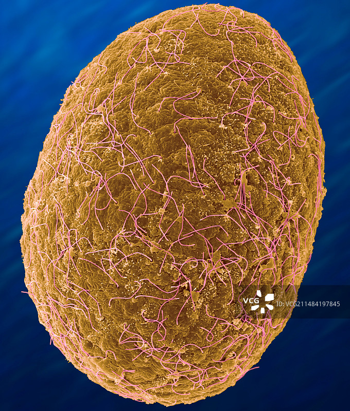 箱形水母幼虫阶段（阿氏箱果冻），扫描电镜图片素材