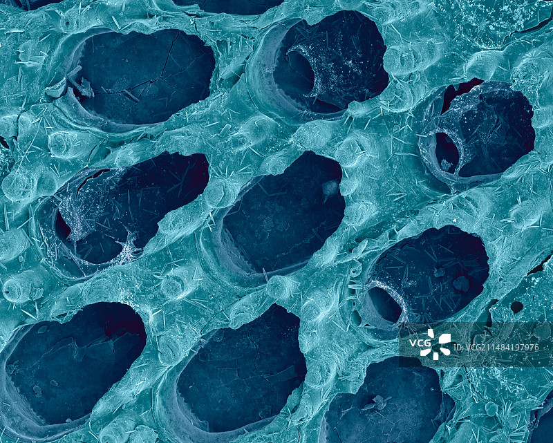 苔藓动物，扫描电镜图片素材