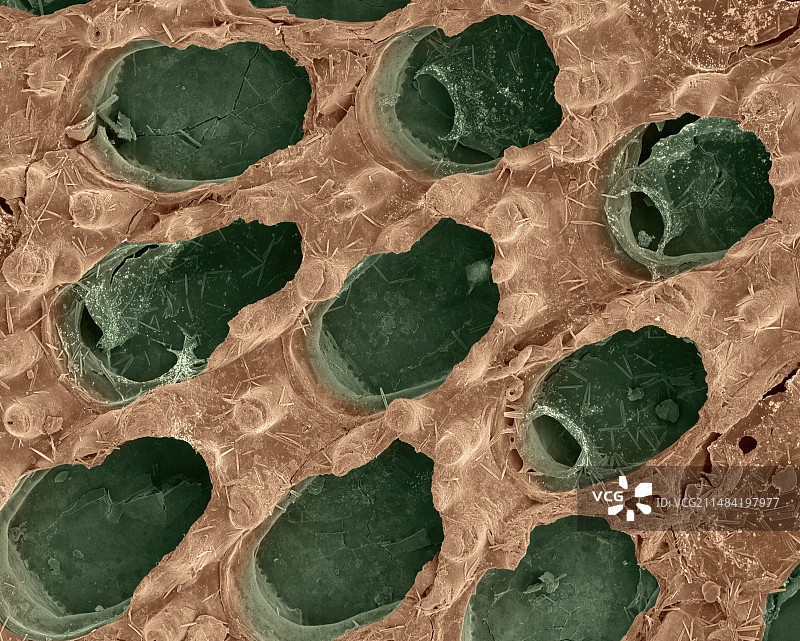 苔藓动物，扫描电镜图片素材