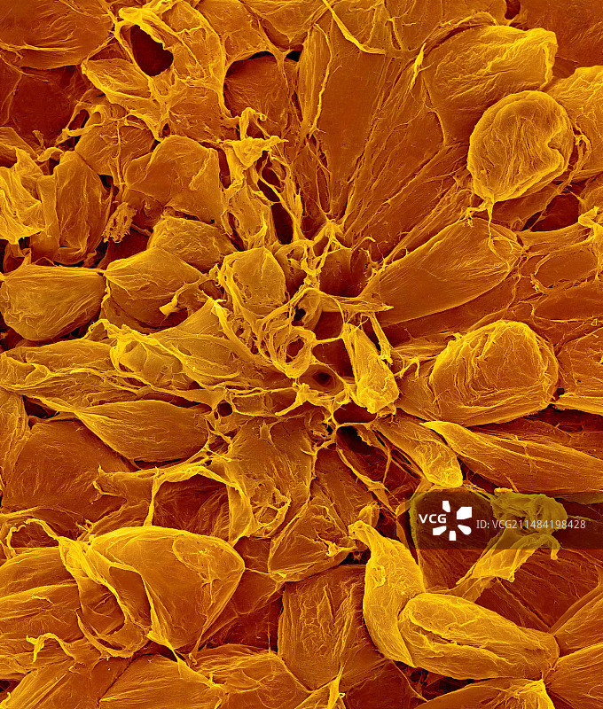 梨果实薄壁细胞（梨属），扫描电镜图片素材