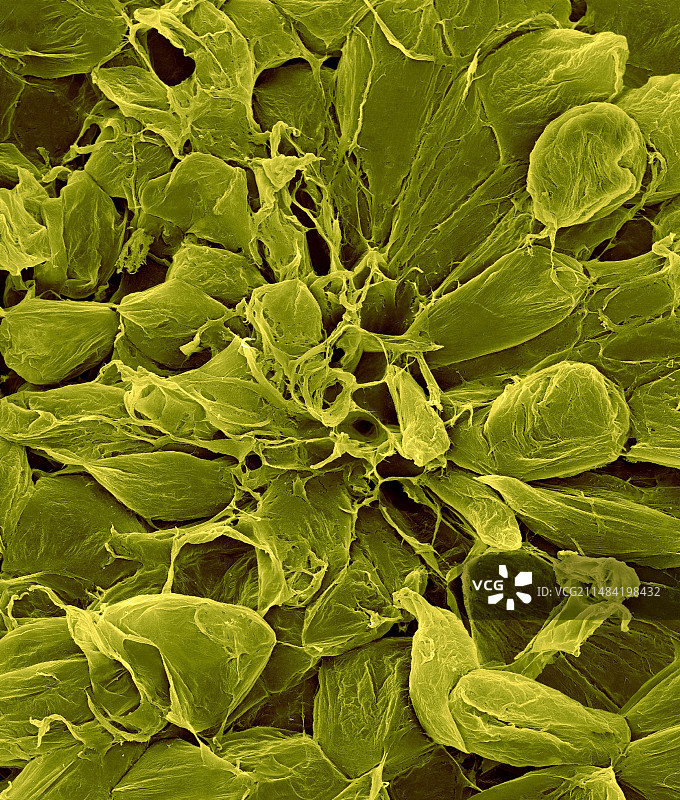 梨果实薄壁细胞（梨属），扫描电镜图片素材