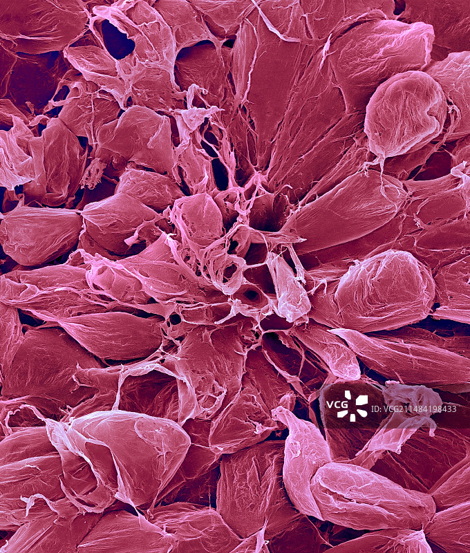 梨果实薄壁细胞（梨属），扫描电镜图片素材