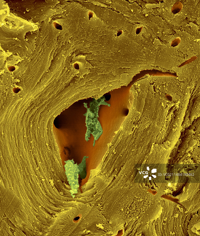 梨子的石细胞（梨属），扫描电镜图片素材