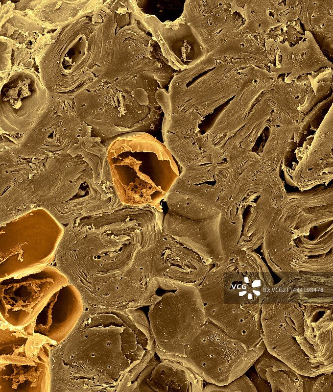 梨的石细胞（梨属），扫描电子显微镜图片素材