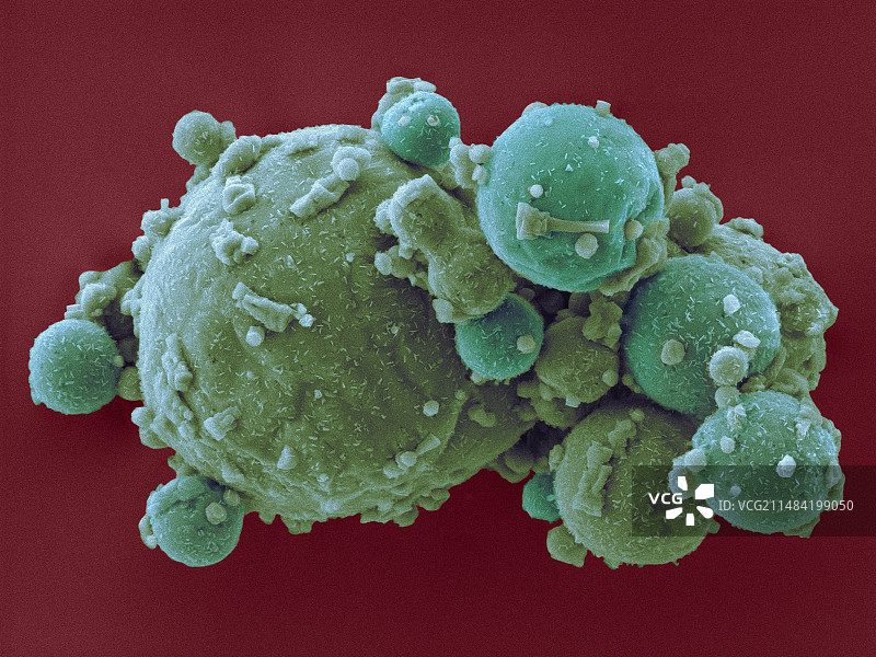 铝（金属）微球扫描电镜图图片素材