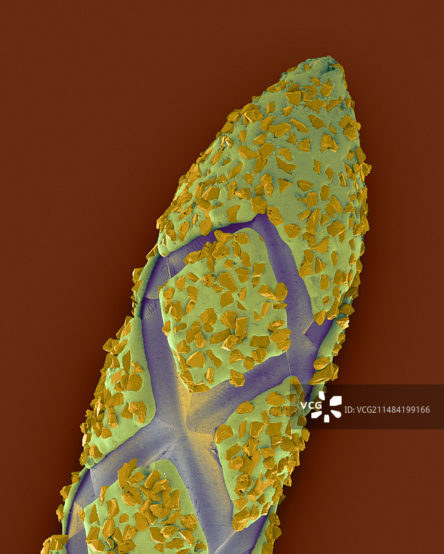 带金刚石碎屑的牙科钻头，扫描电镜图图片素材