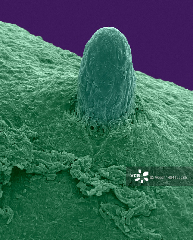 灌木状地衣（松萝属），扫描电镜图片素材