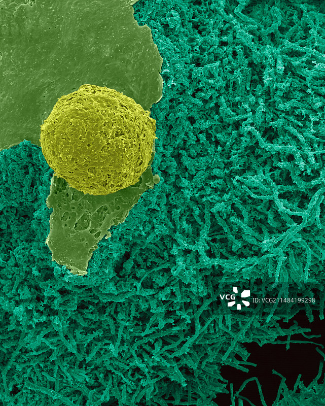 壳状地衣（Xanthoparmelia sp.），扫描电镜图片素材