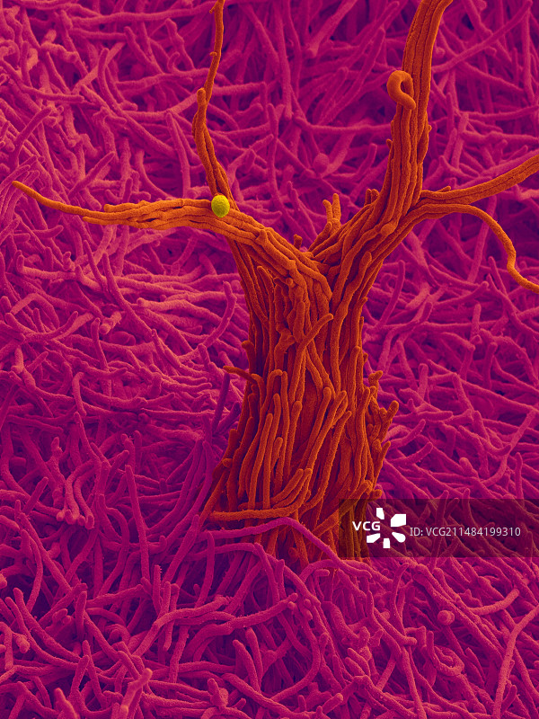 旋刺外瓶霉菌土壤真菌扫描电镜图图片素材