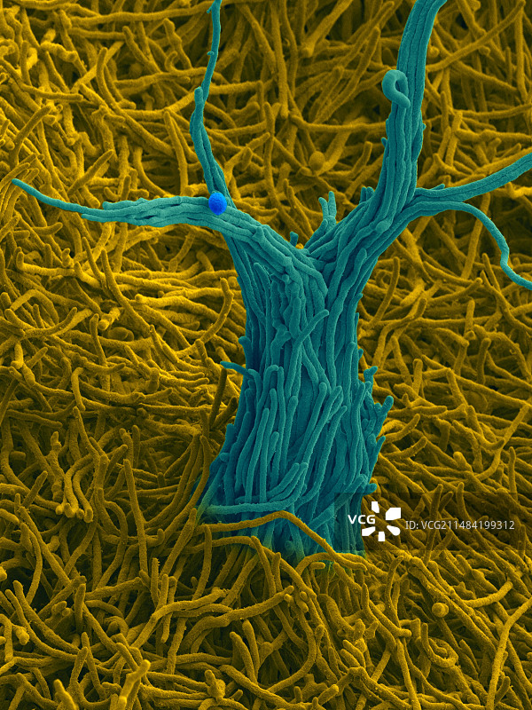 旋刺外瓶霉菌土壤真菌扫描电镜图图片素材