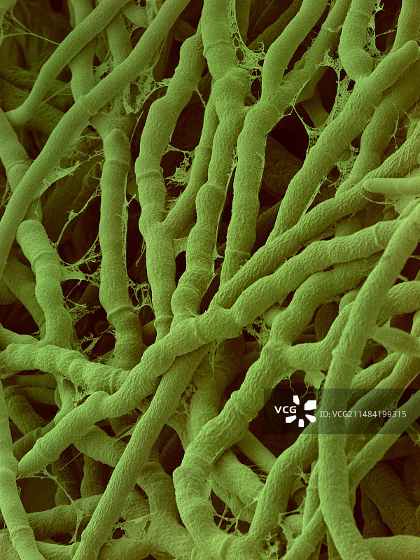 木霉菌担子菌扫描电镜图图片素材