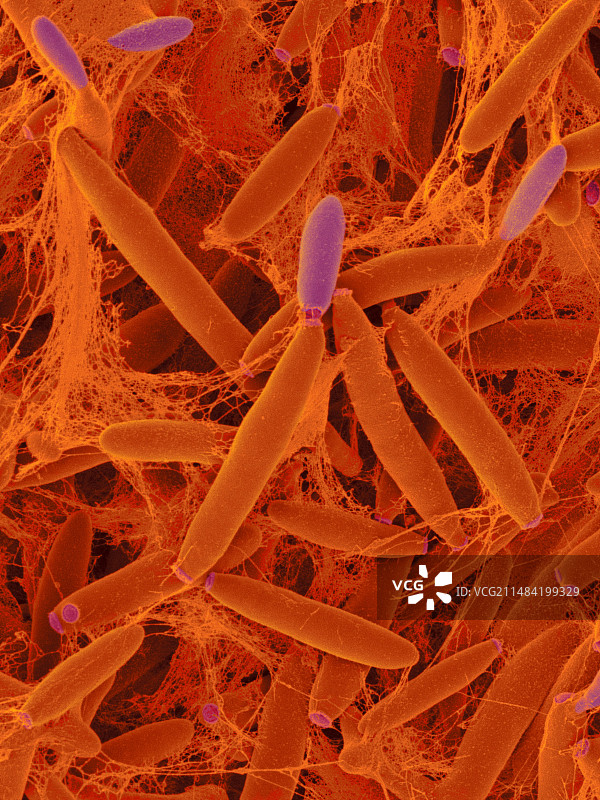 玉米黑粉菌（Ustilago maydis）扫描电镜图图片素材