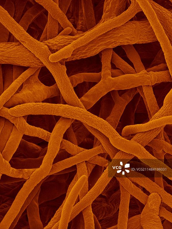 乳色伏革菌扫描电镜图图片素材