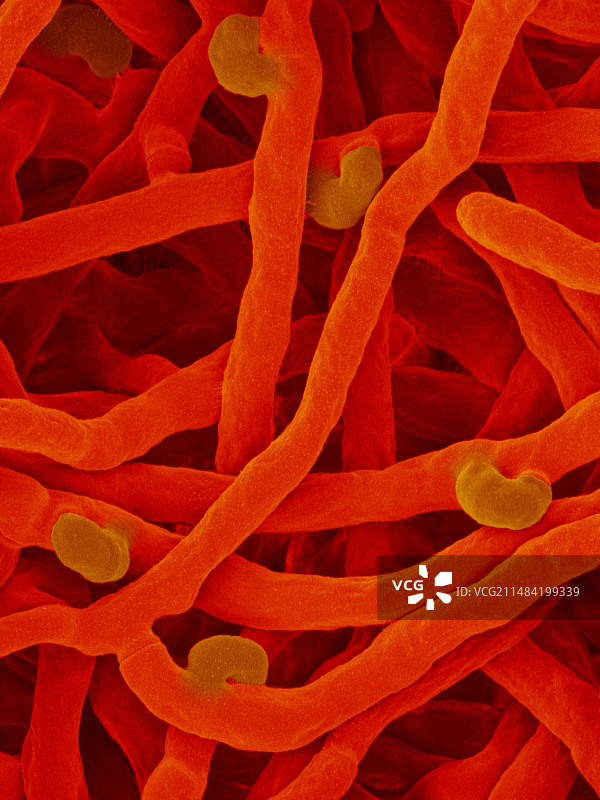 布林克曼氏菌显微照片图片素材