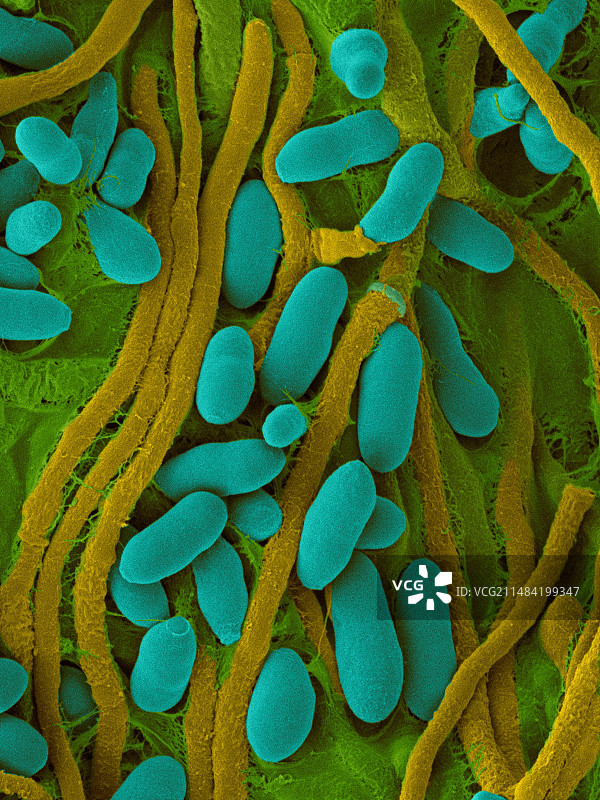 Acremonium stromaticum真菌扫描电镜图图片素材
