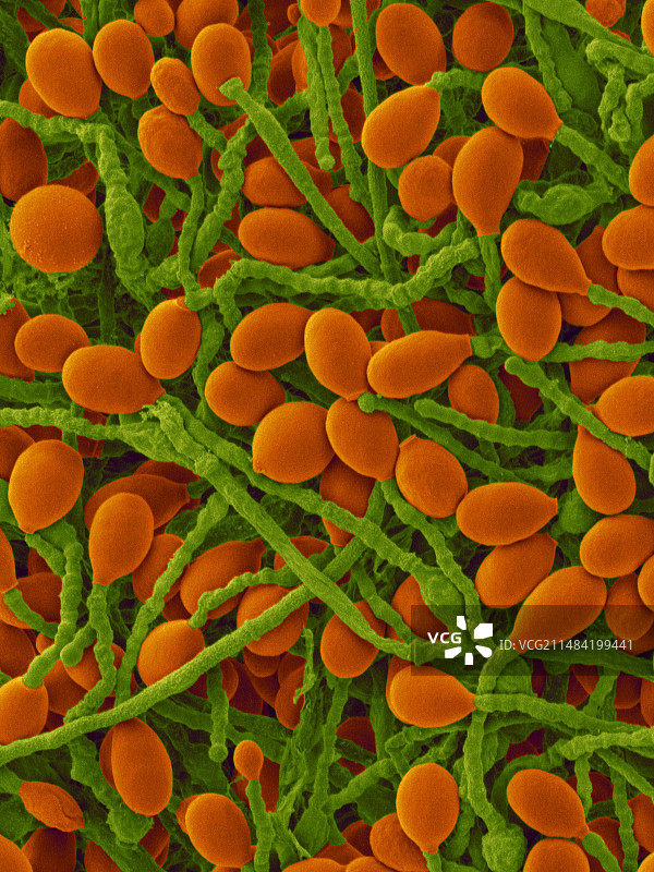 链孢霉菌真菌病原体，扫描电镜图片素材