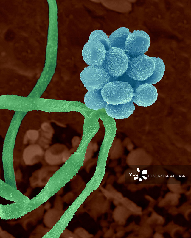 葡萄穗霉菌：有毒霉菌扫描电镜图图片素材