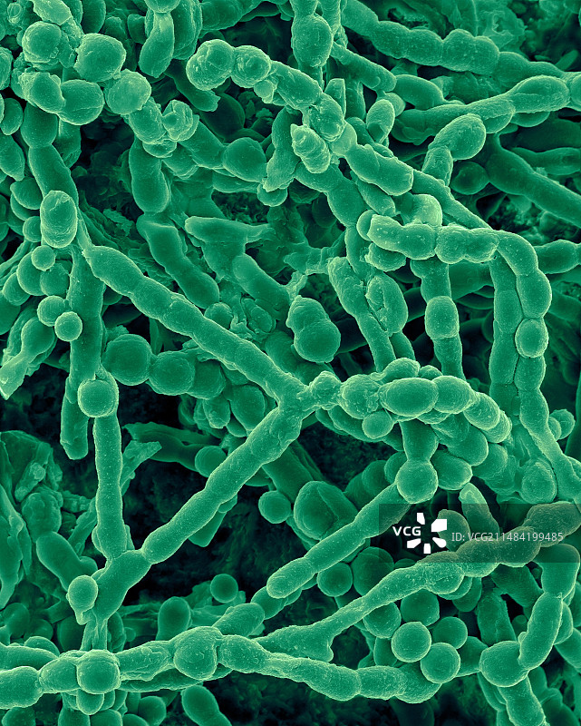 出芽短梗孢的菌丝和孢子，扫描电镜图片素材