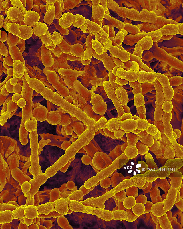 出芽短梗孢的菌丝和孢子，扫描电镜图片素材