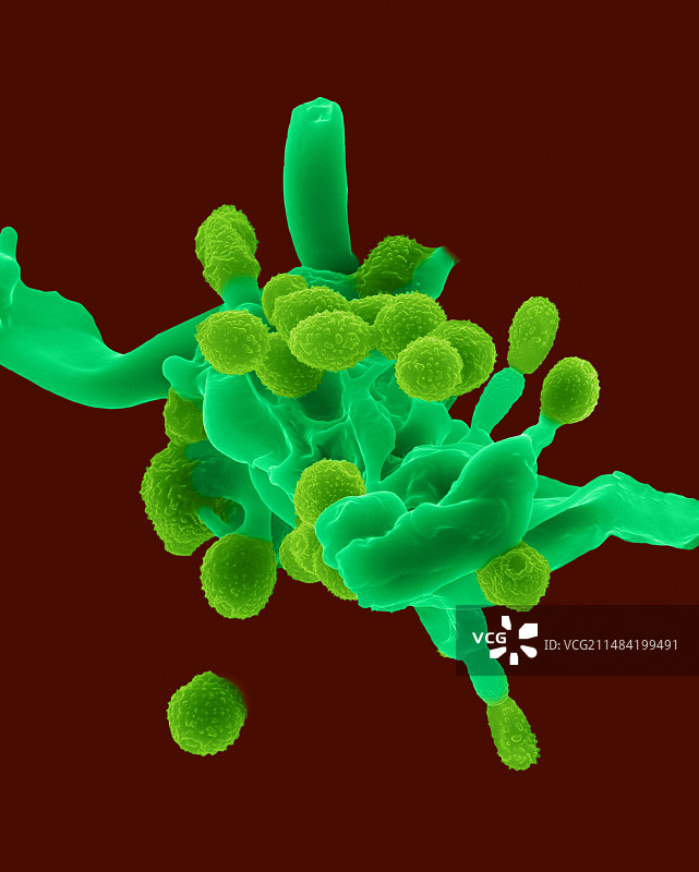 白粉病霉菌菌丝和孢子扫描电镜图图片素材
