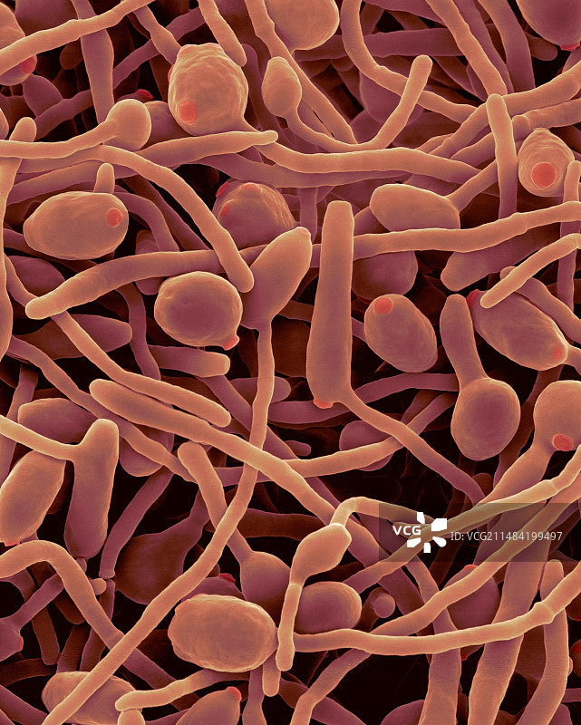 白色念珠菌酵母和菌丝阶段扫描电镜图图片素材