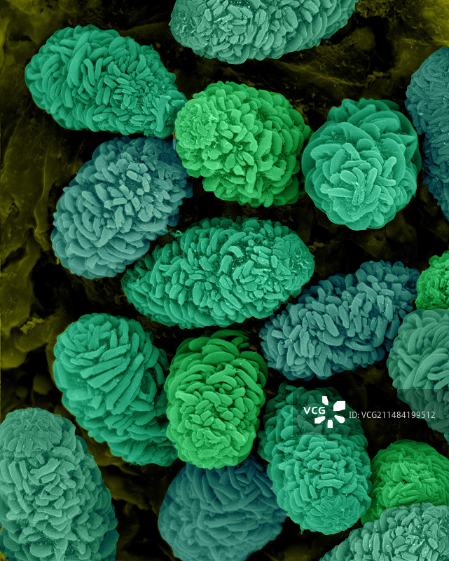 有毒霉菌孢子（Stachybotrys chartarum），扫描电镜图片素材