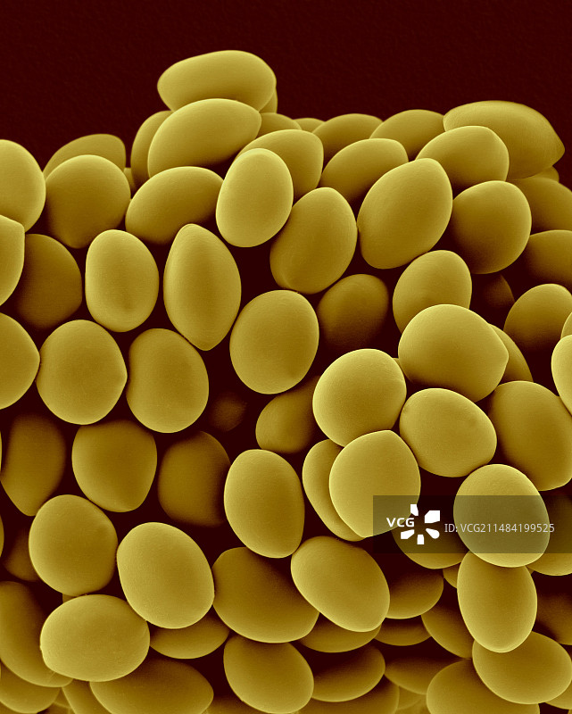 毛壳菌球孢子扫描电镜图图片素材