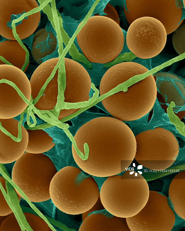 构巢曲霉菌菌丝和有性孢子，扫描电子显微镜图片素材