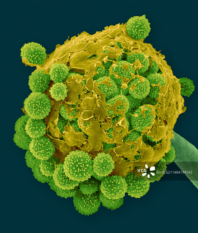 毛霉菌子实体结构扫描电镜图图片素材