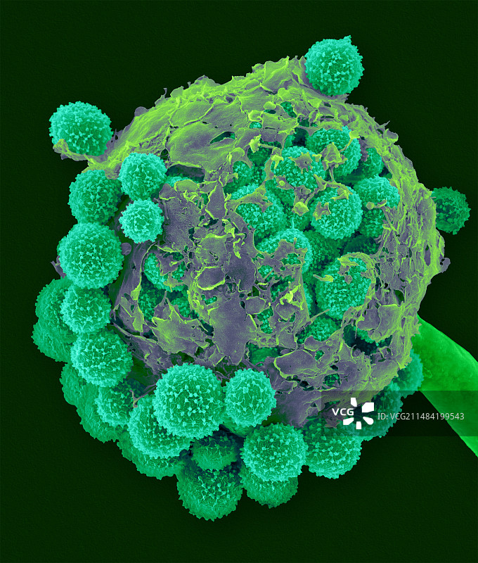 毛霉菌子实体结构扫描电镜图图片素材