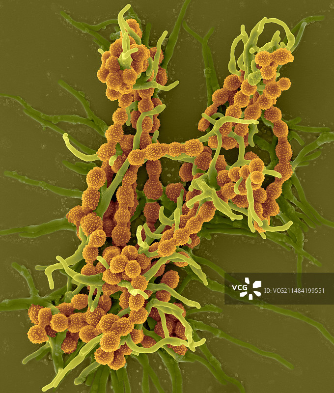 短茎短帚霉，菌丝和孢子，SEM图片素材