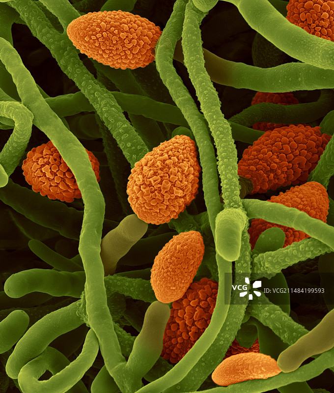 炭黑葡萄孢菌的孢子囊，扫描电镜图片素材