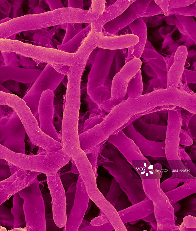 立枯丝核菌植物病原真菌扫描电镜图片素材