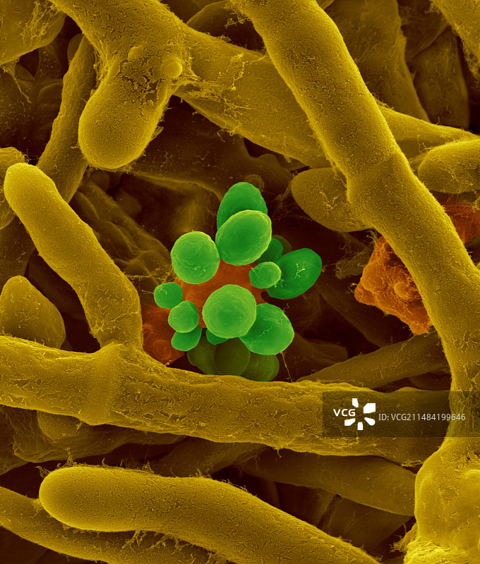 出芽短梗霉菌过敏原（扫描电镜图）图片素材