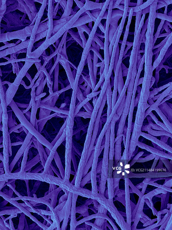 疣状弯孢菌分隔菌丝扫描电镜图图片素材