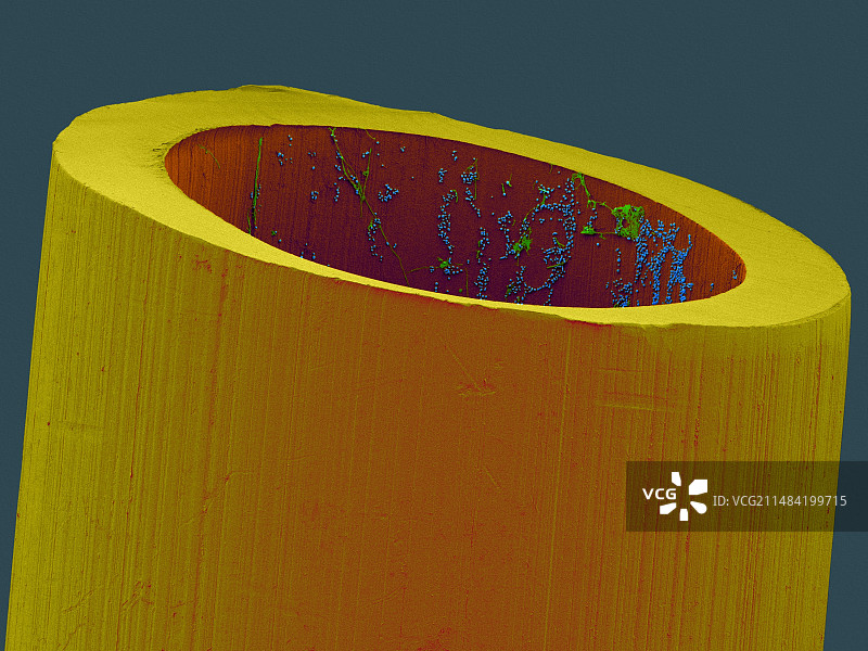 受污染的医用导管扫描电镜图图片素材