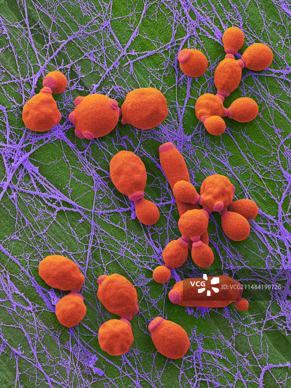 感染念珠菌的医用导管扫描电镜图图片素材