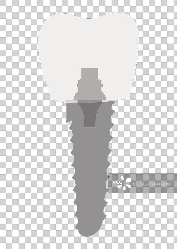 牙科植入体结构医学教育图片素材