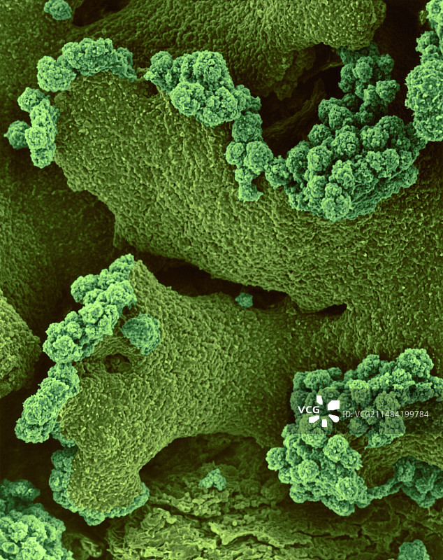 SEM下的黄色梅花衣图片素材