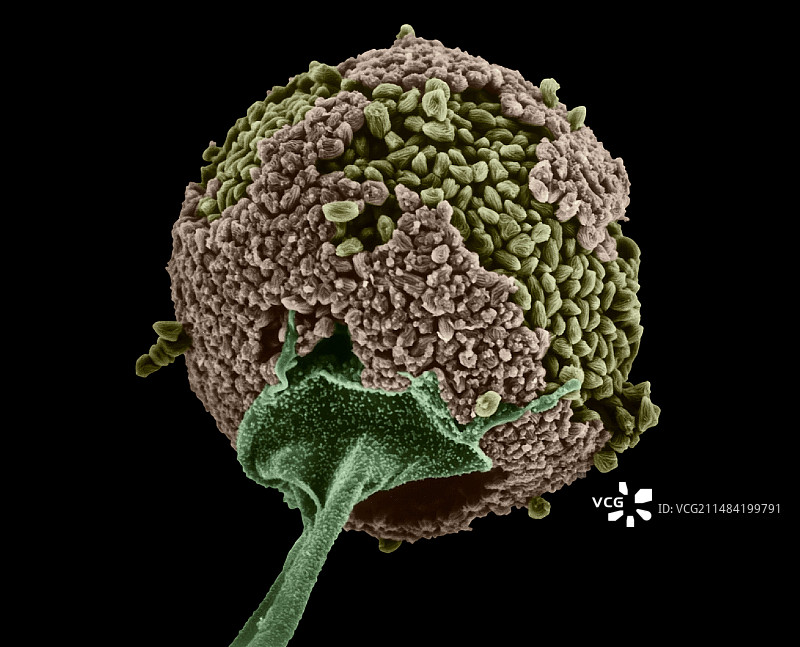 匍枝根霉菌模具（扫描电子显微镜）图片素材