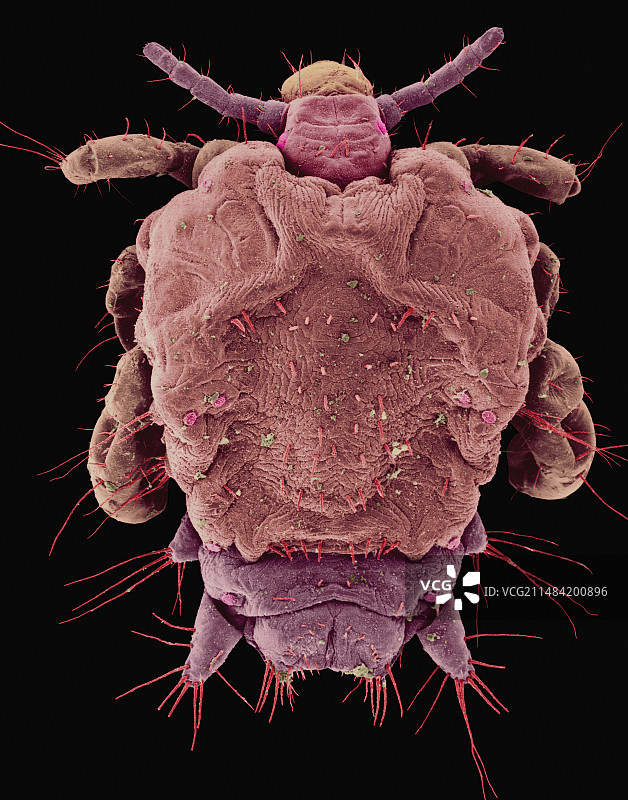 阴虱（扫描电镜）图片素材