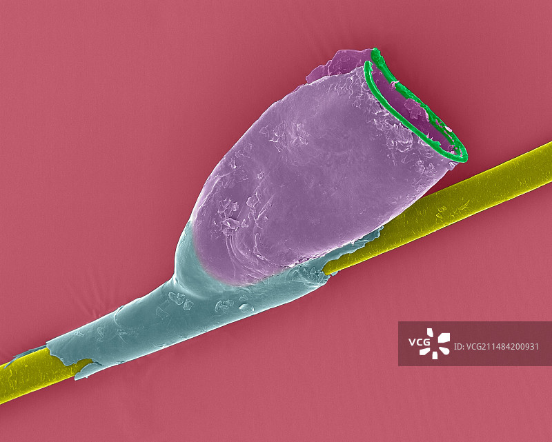 人的头虱卵壳扫描电镜图图片素材