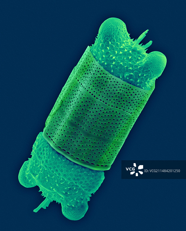 耳状比杜尔藻，扫描电镜图片素材