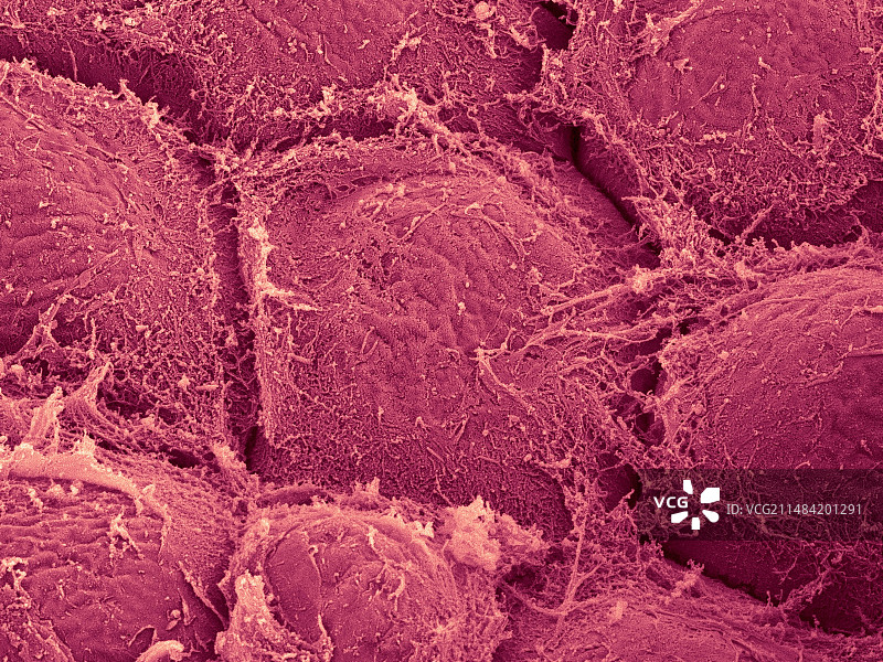 夏威夷珊瑚状红藻，SEM图片素材