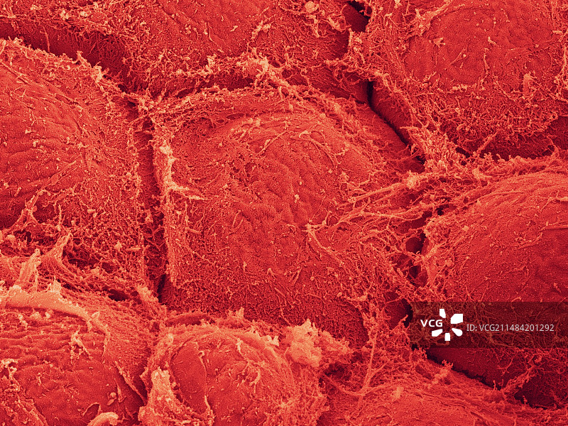 夏威夷珊瑚状红藻，SEM图片素材